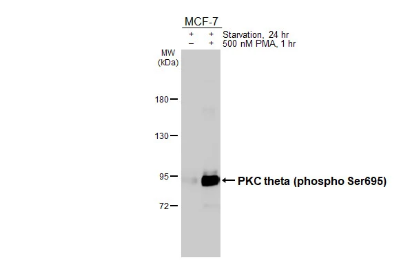 Untreated (–) and treated (+) MCF-7 whole cell extracts (30 μg) were separated by 5% SDS-PAGE, and the membrane was blotted with PKC theta (phospho Ser695) antibody [HL3397] (GTX641234) diluted at 1:2000. The HRP-conjugated anti-rabbit IgG antibody (GTX213110-01) was used to detect the primary antibody.