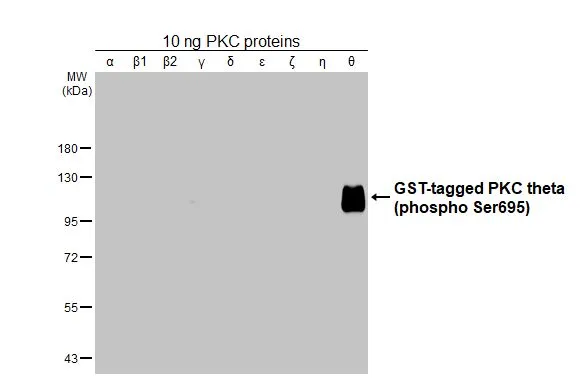 PKC proteins were separated by 7.5% SDS-PAGE, and the membrane was blotted with PKC theta (phospho Ser695) antibody [HL3397] (GTX641234) diluted at 1:1000. The HRP-conjugated anti-rabbit IgG antibody (GTX213110-01) was used to detect the primary antibody.