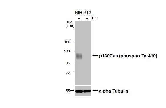 Untreated (–) and treated (+) NIH-3T3 whole cell extracts (30 μg) were separated by 7.5% SDS-PAGE, and the membrane was blotted with p130Cas (phospho Tyr410) antibody [HL3401] (GTX641238) diluted at 1:1000. The HRP-conjugated anti-rabbit IgG antibody (GTX213110-01) was used to detect the primary antibody.