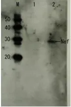 Detection of HIV-1 Nef by Western blotting Lane1: Extract of MT4 cells Lane2: Extract of MT4 cells infected with HIV-1 (LAI strain) The antiserum was diluted 1,000 fold before use. Nef protein band is identified at 27 kDa position