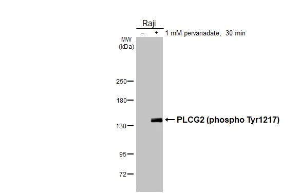 Untreated (–) and treated (+) Raji whole cell extracts (30 μg) were separated by 5% SDS-PAGE, and the membrane was blotted with PLCG2 (phospho Tyr1217) antibody [HL3406] (GTX641243) diluted at 1:1000. The HRP-conjugated anti-rabbit IgG antibody (GTX213110-01) was used to detect the primary antibody.