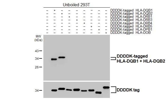 Non-transfected (–) and transfected (+) unboiled 293T whole cell extracts were separated by 12% SDS-PAGE, and the membrane was blotted with HLA-DQB1 antibody [HL3409] (GTX641246) diluted at 1:5000. The HRP-conjugated anti-rabbit IgG antibody (GTX213110-01) was used to detect the primary antibody.