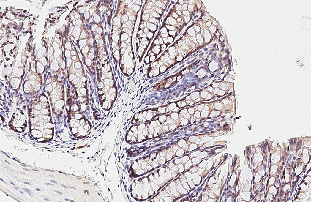 ESRP1 antibody [HL3413] detects ESRP1 protein by immunohistochemical analysis. Sample: Paraffin-embedded mouse colon. ESRP1 stained by ESRP1 antibody [HL3413] (GTX641250) diluted at 1:100. Antigen Retrieval: Citrate buffer, pH 6.0, 15 min