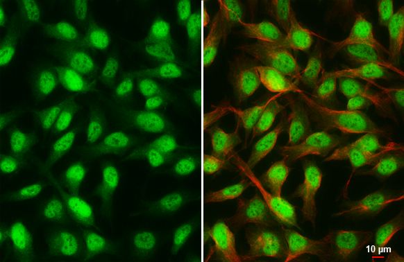 Rad21 antibody [HL3416] detects Rad21 protein by immunofluorescent analysis. Sample: HeLa cells were fixed in 4% paraformaldehyde at RT for 15 min. Green: Rad21 stained by Rad21 antibody [HL3416] (GTX641258) diluted at 1:500. Red: alpha Tubulin, a cytoskeleton marker, stained by alpha Tubulin antibody [GT114] (GTX628802) diluted at 1:1000.