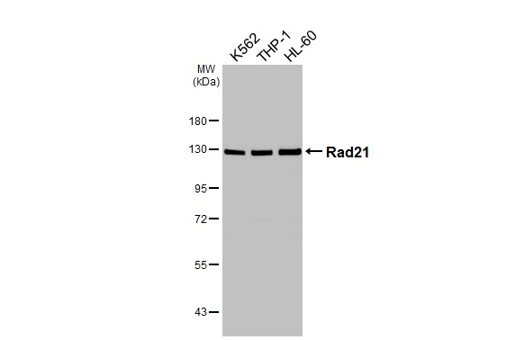 Various whole cell extracts (30 μg) were separated by 7.5% SDS-PAGE, and the membrane was blotted with Rad21 antibody [HL3416] (GTX641258) diluted at 1:1000. The HRP-conjugated anti-rabbit IgG antibody (GTX213110-01) was used to detect the primary antibody.