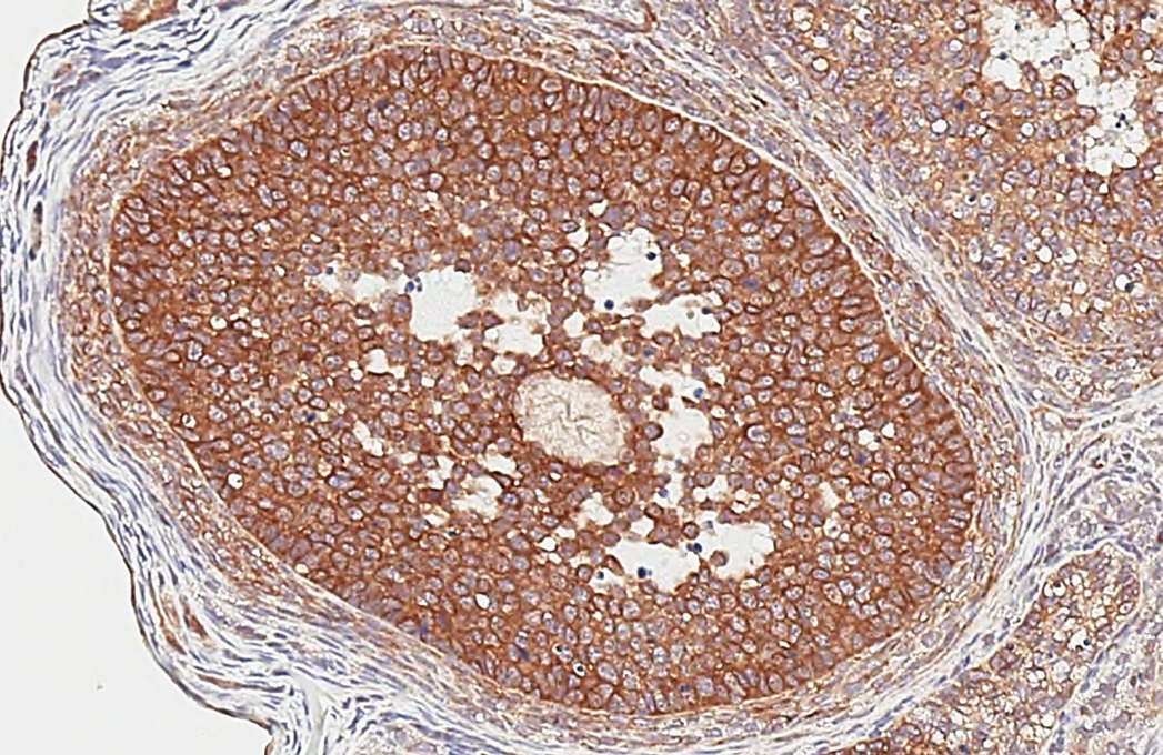 HDAC4 antibody [HL3420] detects HDAC4 protein by immunohistochemical analysis. Sample: Paraffin-embedded rat ovary. HDAC4 stained by HDAC4 antibody [HL3420] (GTX641262) diluted at 1:200. Antigen Retrieval: Citrate buffer, pH 6.0, 15 min