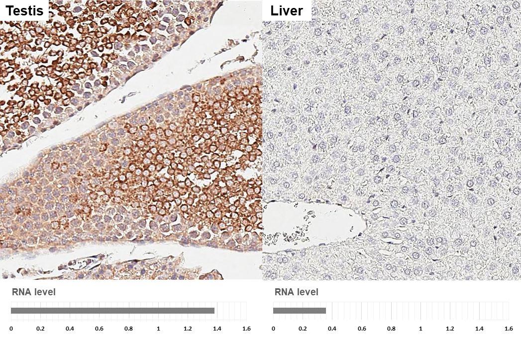 HDAC4 antibody [HL3420] detects HDAC4 protein by immunohistochemical analysis. Sample: Paraffin-embedded rat tissues. HDAC4 stained by HDAC4 antibody [HL3420] (GTX641262) diluted at 1:200. Antigen Retrieval: Citrate buffer, pH 6.0, 15 min Corresponding RNA levels (RPKM) in the tissues are based on NCBI database.