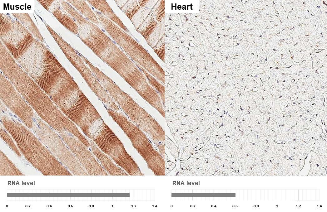 HDAC4 antibody [HL3420] detects HDAC4 protein by immunohistochemical analysis. Sample: Paraffin-embedded rat tissues. HDAC4 stained by HDAC4 antibody [HL3420] (GTX641262) diluted at 1:200. Antigen Retrieval: Citrate buffer, pH 6.0, 15 min Corresponding RNA levels (RPKM) in the tissues are based on NCBI database.