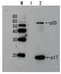 Detection of HIV-1 p17 and its p55 precursor protein by Western blotting using the anti-p17 antibody. Lane 1: Extract of MT4 cells Lane 2: Extract of MT4 cells infected with HIV-1(LAI strain) The antiserum was diluted 2,500 fold before use. Detection of HIV-1 p17 and its p55 precursor protein by Western blotting using the anti-p17 antibody. Lane 1: Extract of MT4 cells Lane 2: Extract of MT4 cells infected with HIV-1(LAI strain) The antiserum was diluted 2,500 fold before use.