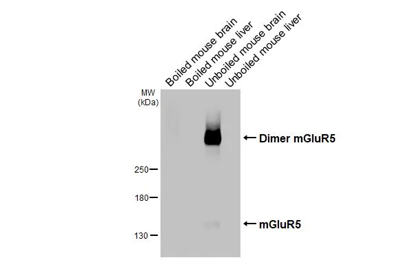 Boiled and unboiled various tissue extracts (50 μg) were separated by 5% SDS-PAGE, and the membrane was blotted with mGluR5 antibody [HL3433] (GTX641275) diluted at 1:1000. The HRP-conjugated anti-rabbit IgG antibody (GTX213110-01) was used to detect the primary antibody.