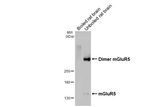 Boiled and unboiled rat tissue extracts (50 μg) were separated by 5% SDS-PAGE, and the membrane was blotted with mGluR5 antibody [HL3433] (GTX641275) diluted at 1:1000. The HRP-conjugated anti-rabbit IgG antibody (GTX213110-01) was used to detect the primary antibody.