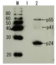Detection of HIV-1 p24 and precursor proteins p55 and p41 by Western blotting using the anti-p24 antibody Lane 1: Extract of MT4 cells Lane 2: Extract of MT4 cells infected with HIV-1(LAI strain). The antiserum was diluted 2,500 fold before use.