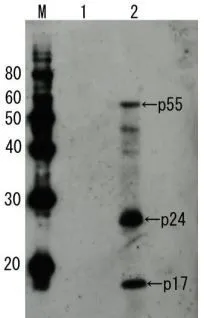 Detection of HIV-1 p55 by Western blotting using the anti-p55 antibody.
