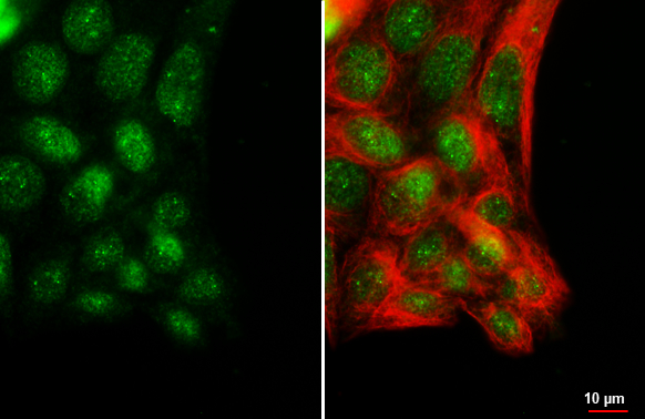 POLR3A antibody [HL3437] detects POLR3A protein by immunofluorescent analysis. Sample: HepG2 cells were fixed in ice-cold MeOH for 5 min. Green: POLR3A stained by POLR3A antibody [HL3437] (GTX641310) diluted at 1:500. Red: alpha Tubulin, a cytoskeleton marker, stained by alpha Tubulin antibody [GT114] (GTX628802) diluted at 1:1000.