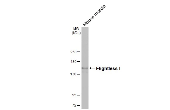 Whole tissue extract (50 μg) was separated by 5% SDS-PAGE, and the membrane was blotted with Flightless I antibod [HL3438] (GTX641311) diluted at 1:1000. The HRP-conjugated anti-rabbit IgG antibody (GTX213110-01) was used to detect the primary antibody.