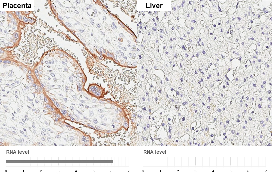 Alkaline phosphatase antibody [HL3439] detects Alkaline phosphatase protein by immunohistochemical analysis. Sample: Paraffin-embedded human tissues. Alkaline phosphatase stained by Alkaline phosphatase antibody [HL3439] (GTX641312) diluted at 1:200. Antigen Retrieval: Citrate buffer, pH 6.0, 15 min Corresponding RNA levels (RPKM) in the tissues are based on NCBI database.