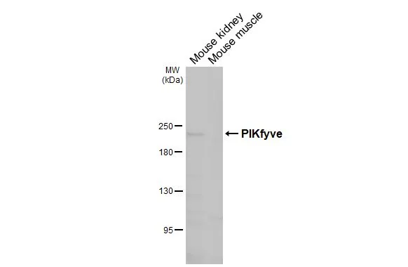 Various tissue extracts (50 μg) were separated by 5% SDS-PAGE, and the membrane was blotted with PIKfyve antibody [HL3449] (GTX641322) diluted at 1:500. The HRP-conjugated anti-rabbit IgG antibody (GTX213110-01) was used to detect the primary antibody, and the signal was developed with Trident ECL plus-Enhanced.