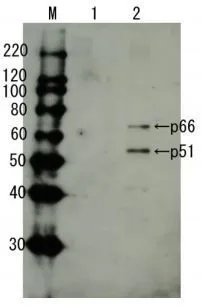 Detection of HIV-1 reverse transcriptase by Western blotting using anti-HIV transcriptase antibody. Lane 1: Extract of MT4 cells Lane 2: Extract of MT4 cells infected with HIV-1 (LAI strain) The antiserum was diluted 2,500 fold before use.
