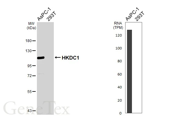 Various whole cell extracts (30 μg) were separated by 7.5% SDS-PAGE, and the membrane was blotted with HKDC1 antibody [HL3464] (GTX641349) diluted at 1:1000. The HRP-conjugated anti-rabbit IgG antibody (GTX213110-01) was used to detect the primary antibody. Corresponding RNA expression data for the same cell lines are based on Human Protein Atlas program.