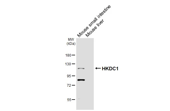 Various tissue extracts (50 μg) were separated by 7.5% SDS-PAGE, and the membrane was blotted with HKDC1 antibody [HL3464] (GTX641349) diluted at 1:1000. The HRP-conjugated anti-rabbit IgG antibody (GTX213110-01) was used to detect the primary antibody.