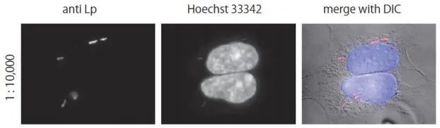 Immunofluorescent staining of Legionella pneumophila in the infected HEK293 cells using anti-Legionella pneumophila antibody. HEK293 cells were infected with Legionella pneumophila strain Philadelphia1 fixed with 4% formaldehyde and reacted with the anti-Legionella pneumophila antibody at 1/10,000 dilution. As the second antibody, goat Rodamine Red X conjugated anti-rabbit IgG antibody was used at 1/10,000 dilution. DNA was stained with Hoechst 33342 (center) and the images were merged with that of differential interference contrast microscope (right).