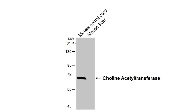 Various tissue extracts (50 μg) were separated by 7.5% SDS-PAGE, and the membranes were blotted with Choline Acetyltransferase antibody [HL3466] (GTX641351) diluted at 1:1000. The HRP-conjugated anti-rabbit IgG antibody (GTX213110-01) was used to detect the primary antibody