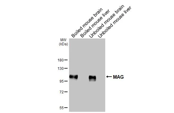 Boiled and unboiled various tissue extracts (50 μg) were separated by 7.5% SDS-PAGE, and the membrane was blotted with MAG antibody [HL3467] (GTX641352) diluted at 1:1000. The HRP-conjugated anti-rabbit IgG antibody (GTX213110-01) was used to detect the primary antibody.