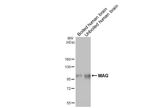 Boiled and unboiled human tissue extract were separated by 7.5% SDS-PAGE, and the membrane was blotted with MAG antibody [HL3467] (GTX641352) diluted at 1:1000. The HRP-conjugated anti-rabbit IgG antibody (GTX213110-01) was used to detect the primary antibody, and the signal was developed with Trident ECL plus-Enhanced.