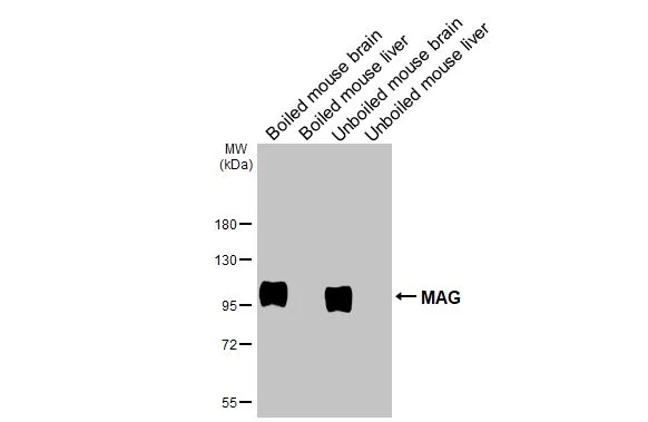 Boiled and unboiled various tissue extracts (50 μg) were separated by 7.5% SDS-PAGE, and the membrane was blotted with MAG antibody [HL3469] (GTX641354) diluted at 1:1000. The HRP-conjugated anti-rabbit IgG antibody (GTX213110-01) was used to detect the primary antibody.