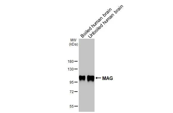 Boiled and unboiled human tissue extract were separated by 7.5% SDS-PAGE, and the membrane was blotted with MAG antibody [HL3469] (GTX641354) diluted at 1:1000. The HRP-conjugated anti-rabbit IgG antibody (GTX213110-01) was used to detect the primary antibody.
