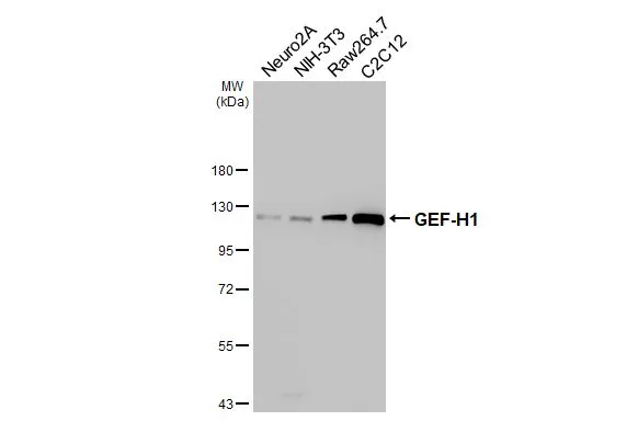 Various whole cell extracts (30 μg) were separated by 7.5% SDS-PAGE, and the membrane was blotted with GEF-H1 antibody [HL3470] (GTX641355) diluted at 1:1000. The HRP-conjugated anti-rabbit IgG antibody (GTX213110-01) was used to detect the primary antibody.