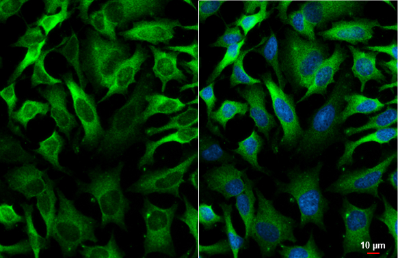 GEF-H1 antibody [HL3470] detects GEF-H1 protein by immunofluorescent analysis. Sample: HeLa cells were fixed in 4% paraformaldehyde at RT for 15 min. Green: GEF-H1 stained by GEF-H1 antibody [HL3470] (GTX641355) diluted at 1:500. Blue: Fluoroshield with DAPI (GTX30920).