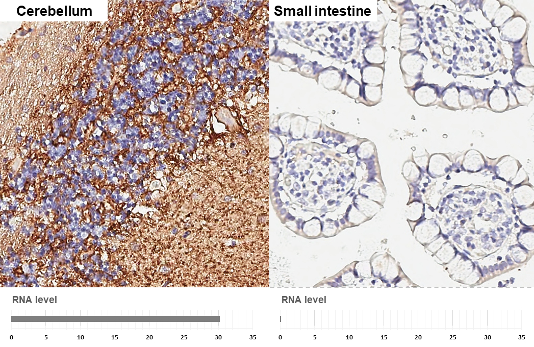 Anti-GABA Transporter 1 / GAT1 antibody [HL3475] (GTX641360) | GeneTex