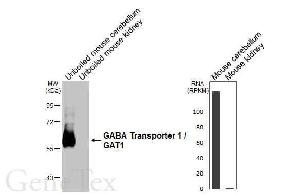 Anti-GABA Transporter 1 / GAT1 antibody [HL3475] (GTX641360) | GeneTex