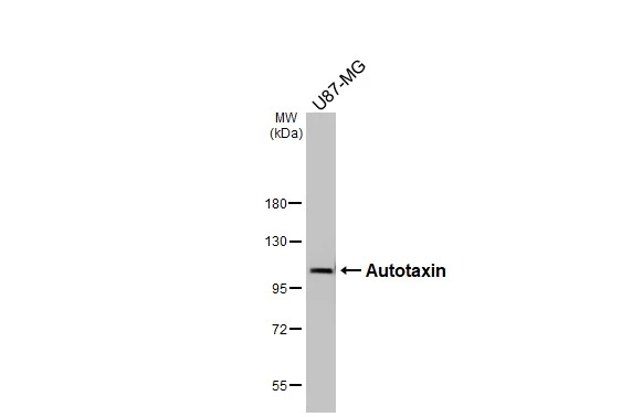 Whole cell extract (30 μg) was separated by 7.5% SDS-PAGE, and the membrane was blotted with Autotaxin antibody [HL3488] (GTX641376) diluted at 1:1000. The HRP-conjugated anti-rabbit IgG antibody (GTX213110-01) was used to detect the primary antibody.