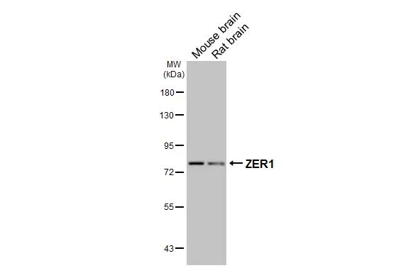 Various tissue extracts (50 μg) were separated by 7.5% SDS-PAGE, and the membrane was blotted with ZER1 antibody [HL3491] (GTX641379) diluted at 1:1000. The HRP-conjugated anti-rabbit IgG antibody (GTX213110-01) was used to detect the primary antibody.
