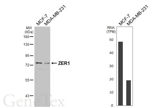 Various whole cell extracts (30 μg) were separated by 7.5% SDS-PAGE, and the membrane was blotted with ZER1 antibody [HL3491] (GTX641379) diluted at 1:1000. The HRP-conjugated anti-rabbit IgG antibody (GTX213110-01) was used to detect the primary antibody. Corresponding RNA expression data for the same cell lines are based on Human Protein Atlas program.