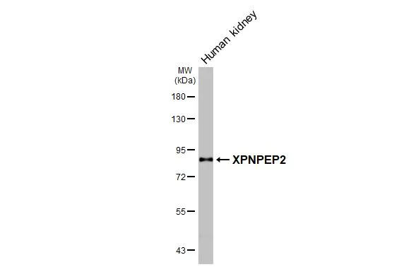 Human tissue extract was separated by 7.5% SDS-PAGE, and the membrane was blotted with XPNPEP2 antibody [HL3492] (GTX641380) diluted at 1:1000. The HRP-conjugated anti-rabbit IgG antibody (GTX213110-01) was used to detect the primary antibody.