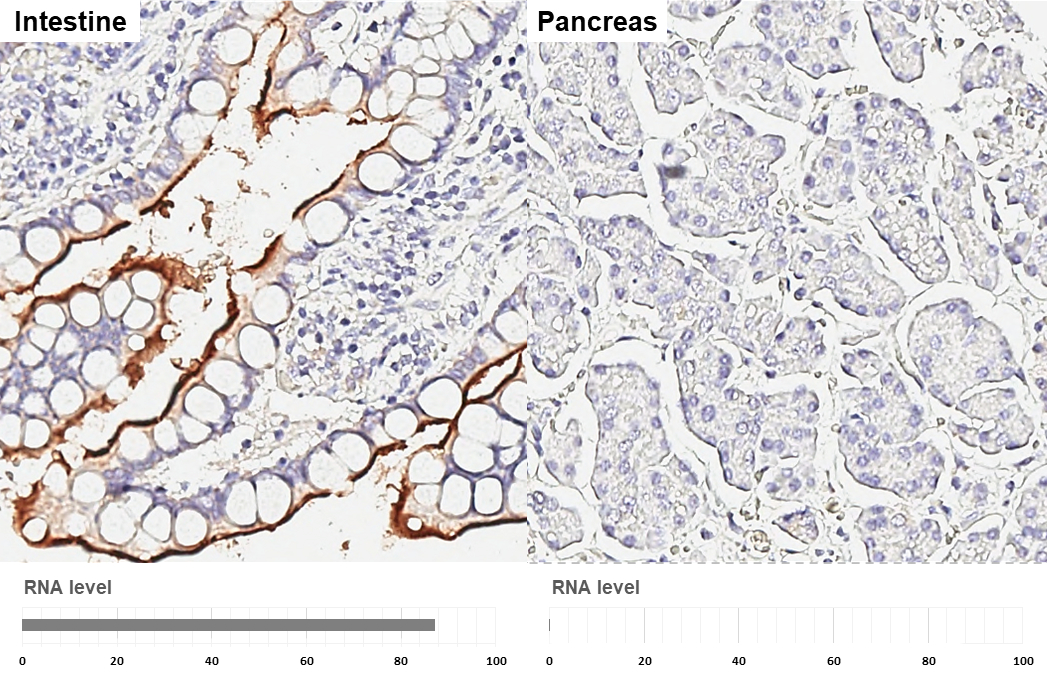 XPNPEP2 antibody [HL3492] detects XPNPEP2 protein by immunohistochemical analysis. Sample: Paraffin-embedded human tissues. XPNPEP2 stained by XPNPEP2 antibody [HL3492] (GTX641380) diluted at 1:250. Antigen Retrieval: Citrate buffer, pH 6.0, 15 min Corresponding RNA levels (RPKM) in the tissues are based on NCBI database.