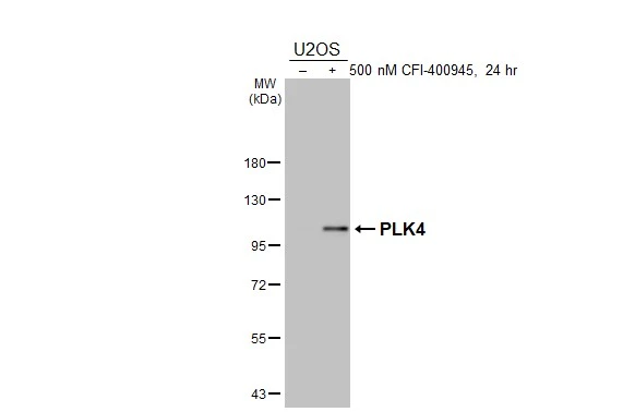 Untreated (–) and treated (+) U2OS whole cell extract (30 μg) were separated by 7.5% SDS-PAGE, and the membrane was blotted with PLK4 antibody [HL3493] (GTX641381) diluted at 1:1000. The HRP-conjugated anti-rabbit IgG antibody (GTX213110-01) was used to detect the primary antibody.