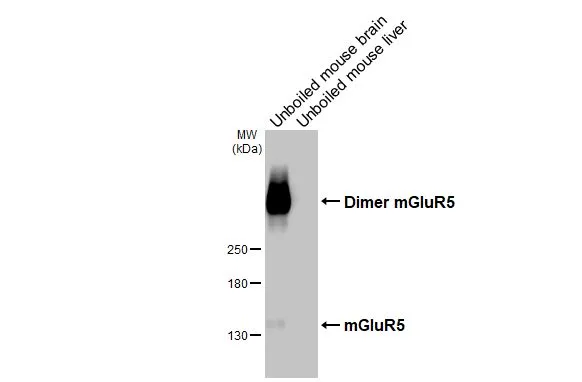 Unboiled various tissue extracts (50 μg) were separated by 5% SDS-PAGE, and the membrane was blotted with mGluR5 antibody [HL3509] (GTX641397) diluted at 1:1000. The HRP-conjugated anti-rabbit IgG antibody (GTX213110-01) was used to detect the primary antibody, and the signal was developed with Trident ECL plus-Enhanced.