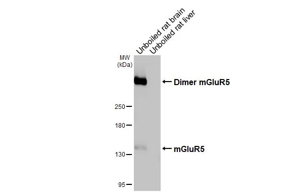Unboiled various tissue extracts (50 μg) were separated by 5% SDS-PAGE, and the membrane was blotted with mGluR5 antibody [HL3509] (GTX641397) diluted at 1:1000. The HRP-conjugated anti-rabbit IgG antibody (GTX213110-01) was used to detect the primary antibody.