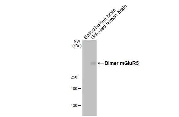 Boiled and unboiled human tissue extract (5 μg) were separated by 5% SDS-PAGE, and the membrane was blotted with mGluR5 antibody [HL3509] (GTX641397) diluted at 1:1000. The HRP-conjugated anti-rabbit IgG antibody (GTX213110-01) was used to detect the primary antibody, and the signal was developed with Trident ECL plus-Enhanced.