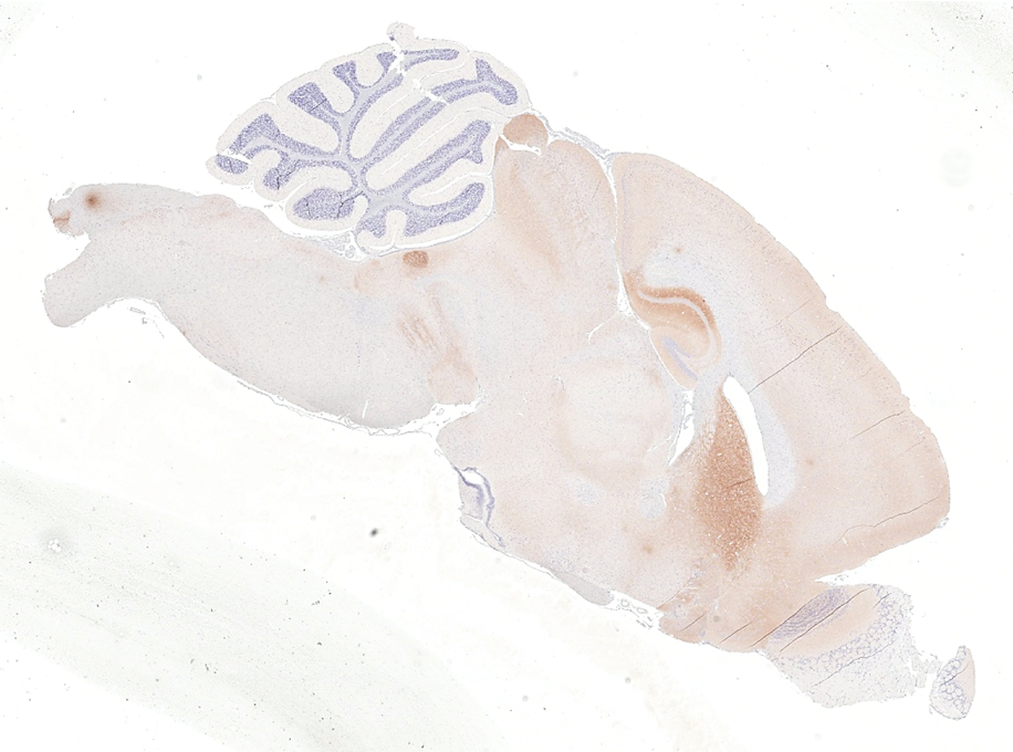 mGluR5 antibody [HL3509] detects mGluR5 protein by immunohistochemical analysis. Sample: Paraffin-embedded mouse brain (striatum). mGluR5 stained by mGluR5 antibody [HL3509] (GTX641397) diluted at 1:400. Antigen Retrieval: Citrate buffer, pH 6.0, 15 min