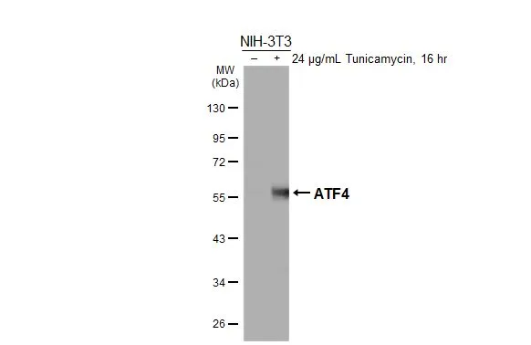 Untreated (–) and treated (+) NIH-3T3 whole cell extract (30 μg) were separated by 10% SDS-PAGE, and the membrane was blotted with ATF4 antibody [HL3513] (GTX641410) diluted at 1:1000. The HRP-conjugated anti-rabbit IgG antibody (GTX213110-01) was used to detect the primary antibody.