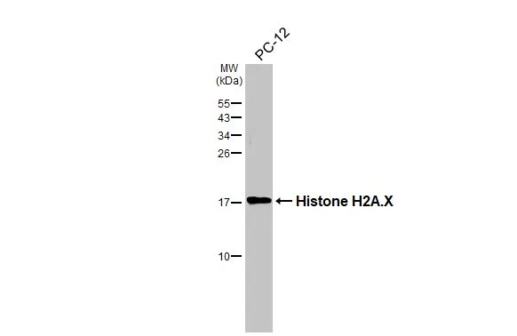 Whole cell extract (30 μg) was separated by 15% SDS-PAGE, and the membrane was blotted with Histone H2A.X antibody [HL3515] (GTX641412) diluted at 1:1000. The HRP-conjugated anti-rabbit IgG antibody (GTX213110-01) was used to detect the primary antibody.