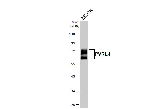 Whole cell extract (30 μg) was separated by 10% SDS-PAGE, and the membrane was blotted with PVRL4 antibody [HL3520] (GTX641417) diluted at 1:1000. The HRP-conjugated anti-rabbit IgG antibody (GTX213110-01) was used to detect the primary antibody.