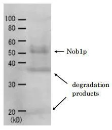 Detection of Nob1p (51.7kD) in the crude extract of S. cerevisiae by Western blotting using this antibody Detection of Nob1p (51.7kD) in the crude extract of S. cerevisiae by Western blotting using this antibody
