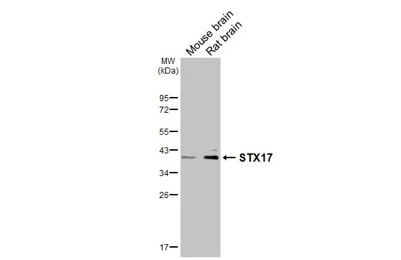 Various tissue extracts (50 μg) were separated by 12% SDS-PAGE, and the membrane was blotted with STX17 antibody [HL3534] (GTX641431) diluted at 1:1000. The HRP-conjugated anti-rabbit IgG antibody (GTX213110-01) was used to detect the primary antibody.