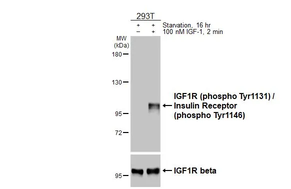 Untreated (–) and treated (+) 293T whole cell extracts (30 μg) were separated by 5% SDS-PAGE, and the membranes were blotted with IGF1R (phospho Tyr1131) / Insulin Receptor (phospho Tyr1146) antibody [HL3537] (GTX641434) diluted at 1:1000 and IGF1R beta antibody [HL1958] (GTX637795) diluted at 1:1000. The HRP-conjugated anti-rabbit IgG antibody (GTX213110-01) was used to detect the primary antibody.